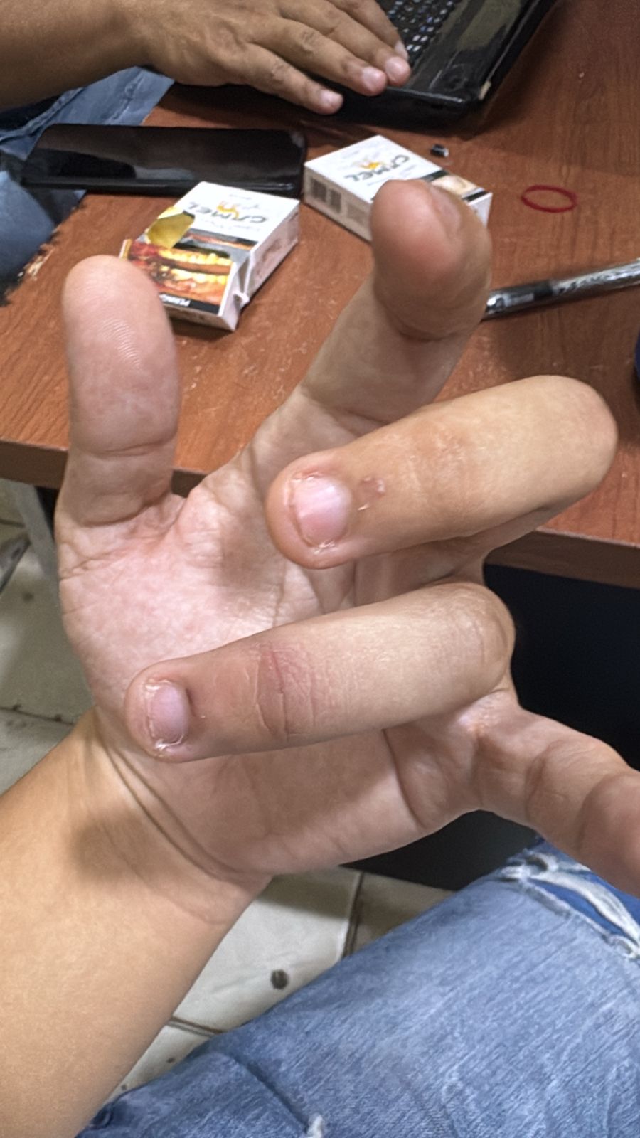 Kasus Dugaan Penganiayaan Belum Tuntas, Keluarga Korban Soroti Kinerja Polsek Tanjungkarang Timur